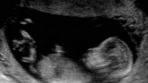 Thumbnail for Abortion & Libertarians: Nick Gillespie, Ronald Bailey, Mollie Hemingway & Katherine Mangu-Ward