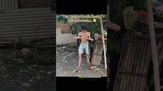 Thumbnail for This Condition Looks Extremely Painful… 😔 #interesting | IdkSterling