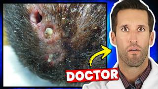 Thumbnail for The Most Disturbing Parasites Found Inside Humans | Doctor ER