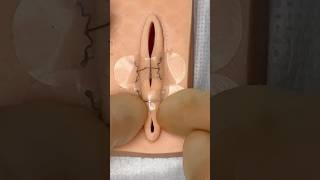 Thumbnail for Micromend Easiest Stitches #goodtoknow #stitches #suturing #medicine #innovation #vet #surgeonlife | Vetventures