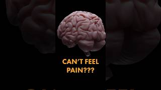 Thumbnail for This is the REAL reason headaches hurt | Be Smart