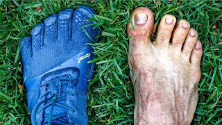 Thumbnail for 2 Years in Barefoot Shoes... My Feet Aren't The Same! | Mike Hanna