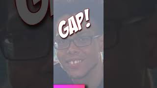Thumbnail for Just Lose The Weight!!! (You're Not Ugly) #loseweightchallenge #fatjokes #attractive | CGscrubs