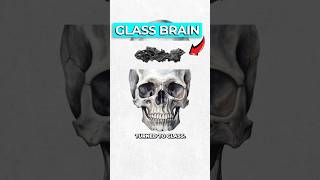 Thumbnail for Archaeologists Discover Glass Brain | Dr Ben Miles