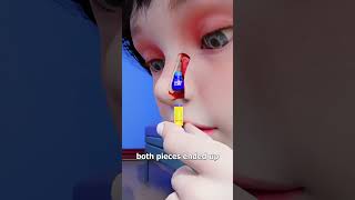 Thumbnail for Lego Stuck In Nose For 26 Years 😨 | Zack D. Films