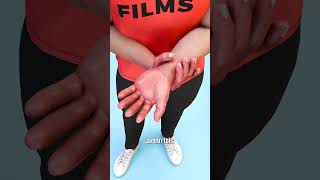 Thumbnail for How Bee Sting Therapy Works 😮 | Zack D. Films