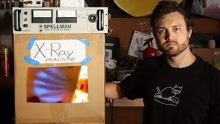 Thumbnail for Built My Own X-Ray After a Hospital Charged Me $69,210.32 | William Osman