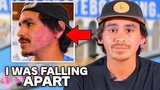 Thumbnail for This is why Carlos Lastra Quit Braille Skateboarding | Progress Daily