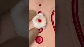 Thumbnail for Gunshot Wound First Aid ⛑️ #emergency #goodtoknow #firstaid #vet #medicine #funfacts #surgeonlife | Vetventures