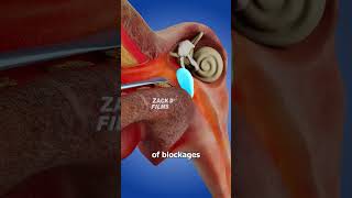 Thumbnail for How Ear Spoons Work 🤔 | Zack D. Films