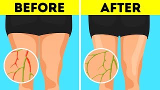 Thumbnail for 6 Simple Exercises to Stay Active Without Special Equipment | BRIGHT SIDE