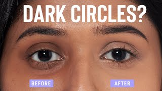 Thumbnail for Home remedies to remove dark circles QUICKLY and NATURALLY! | Glamrs