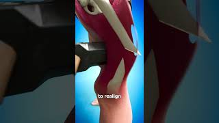 Thumbnail for How Broken Bones Are Fixed 🤔 | Zack D. Films