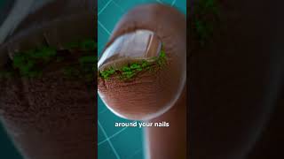 Thumbnail for Why You Shouldn't Bite Your Nails 😖 | Zack D. Films