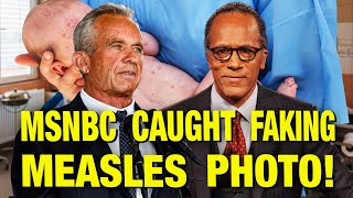 Thumbnail for NBC Doctored Up This Photo Of A Baby With Measles! | The Jimmy Dore Show